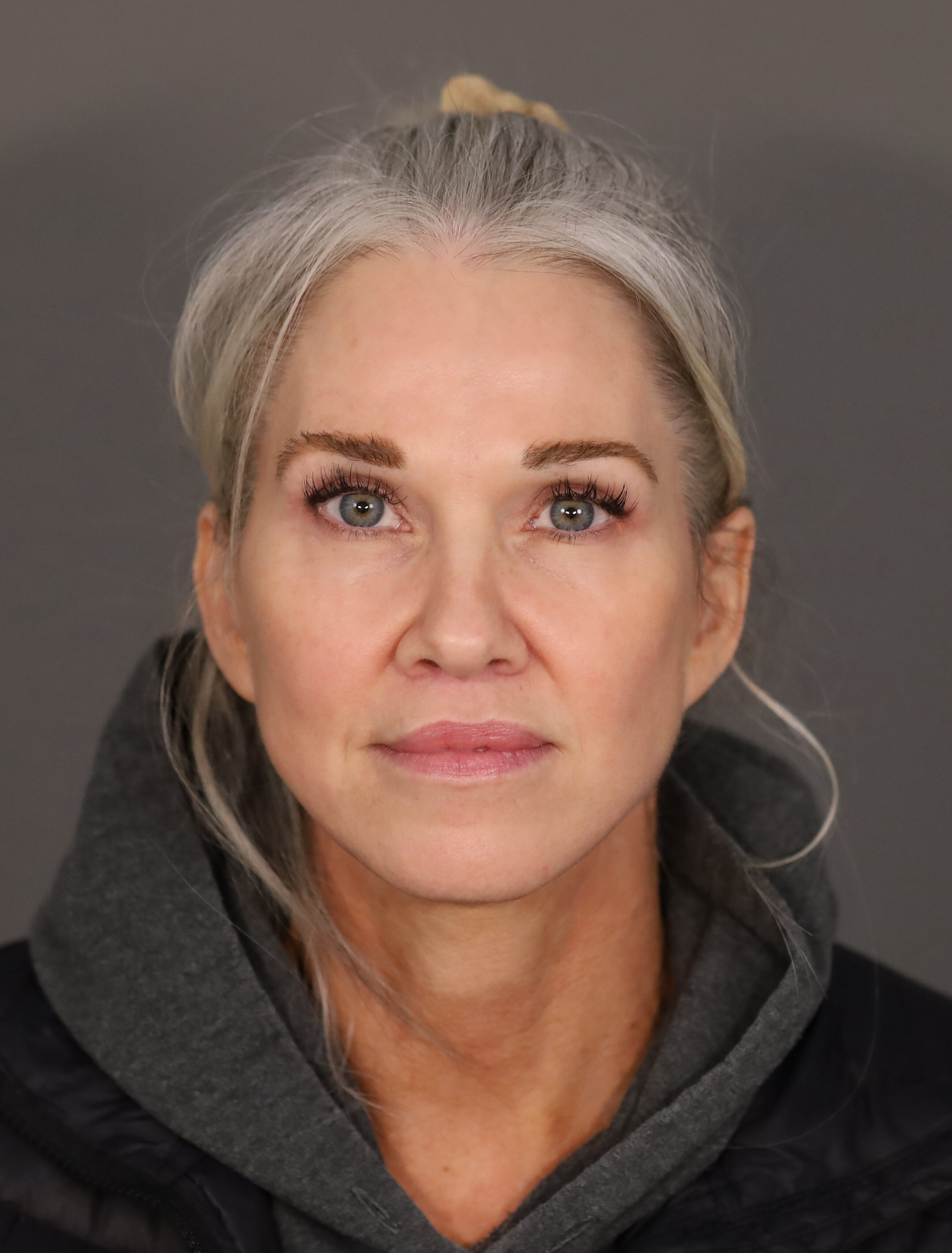 Shannon M Frontal Post