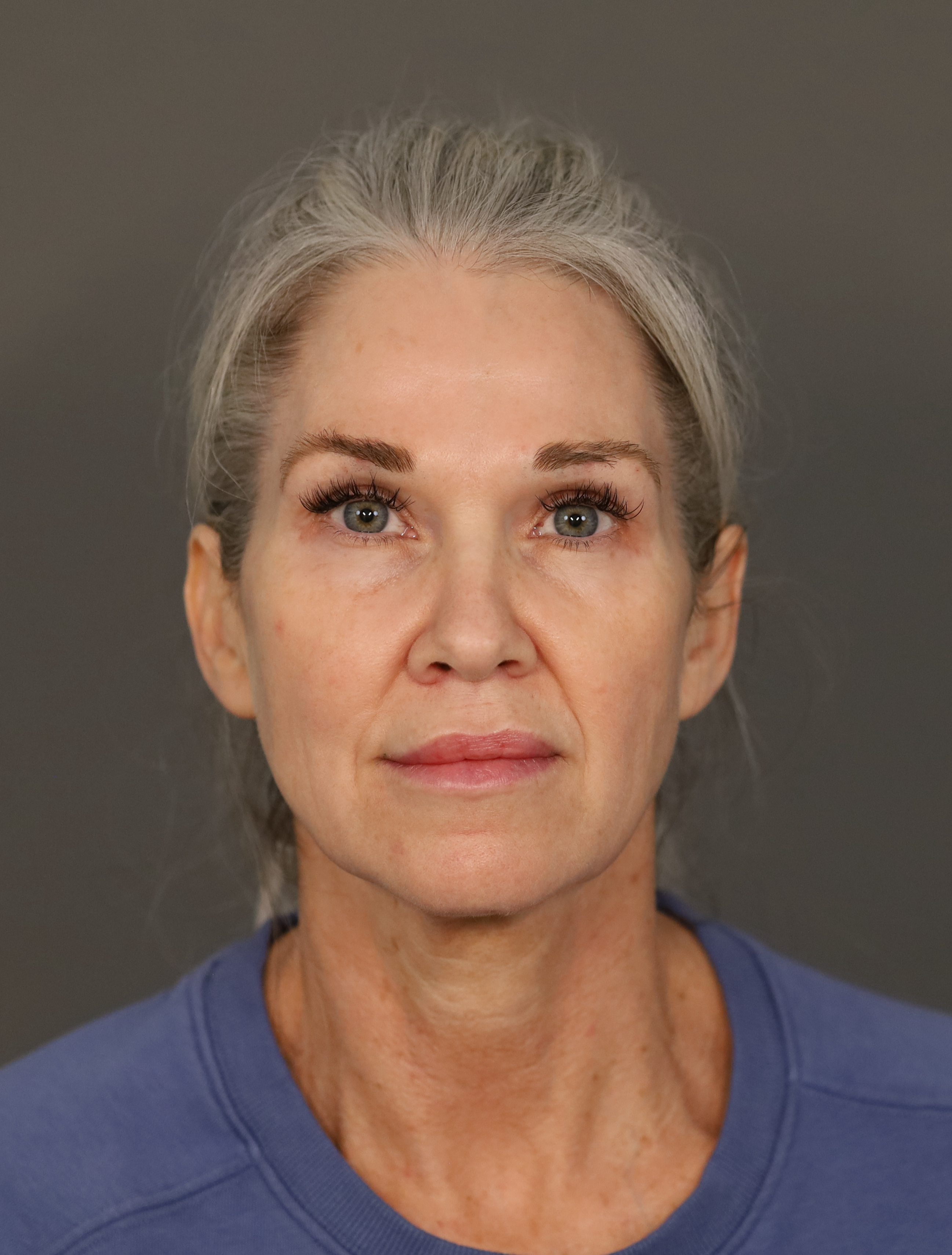 Shannon M Frontal Pre