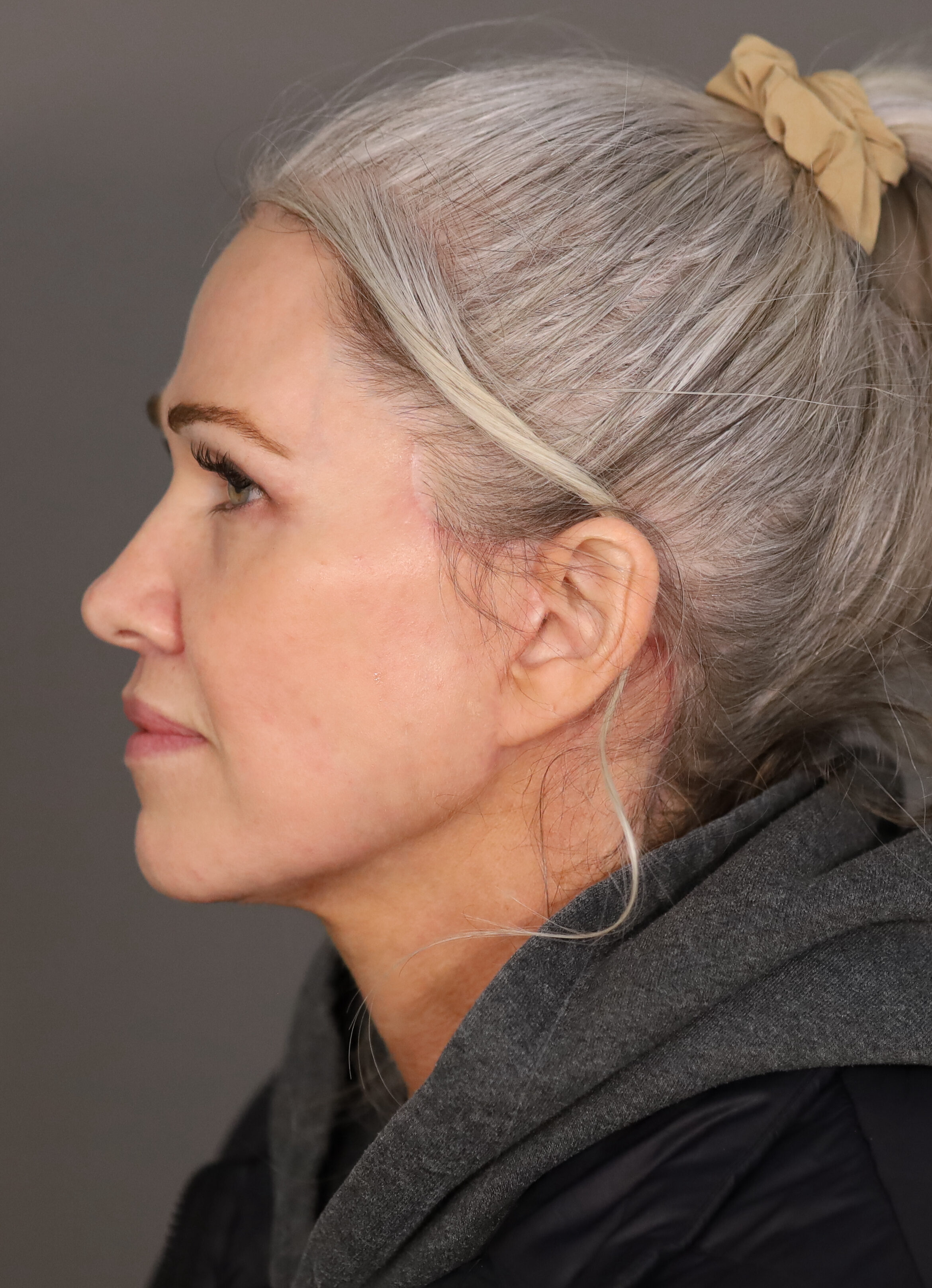 Shannon M Lateral Post