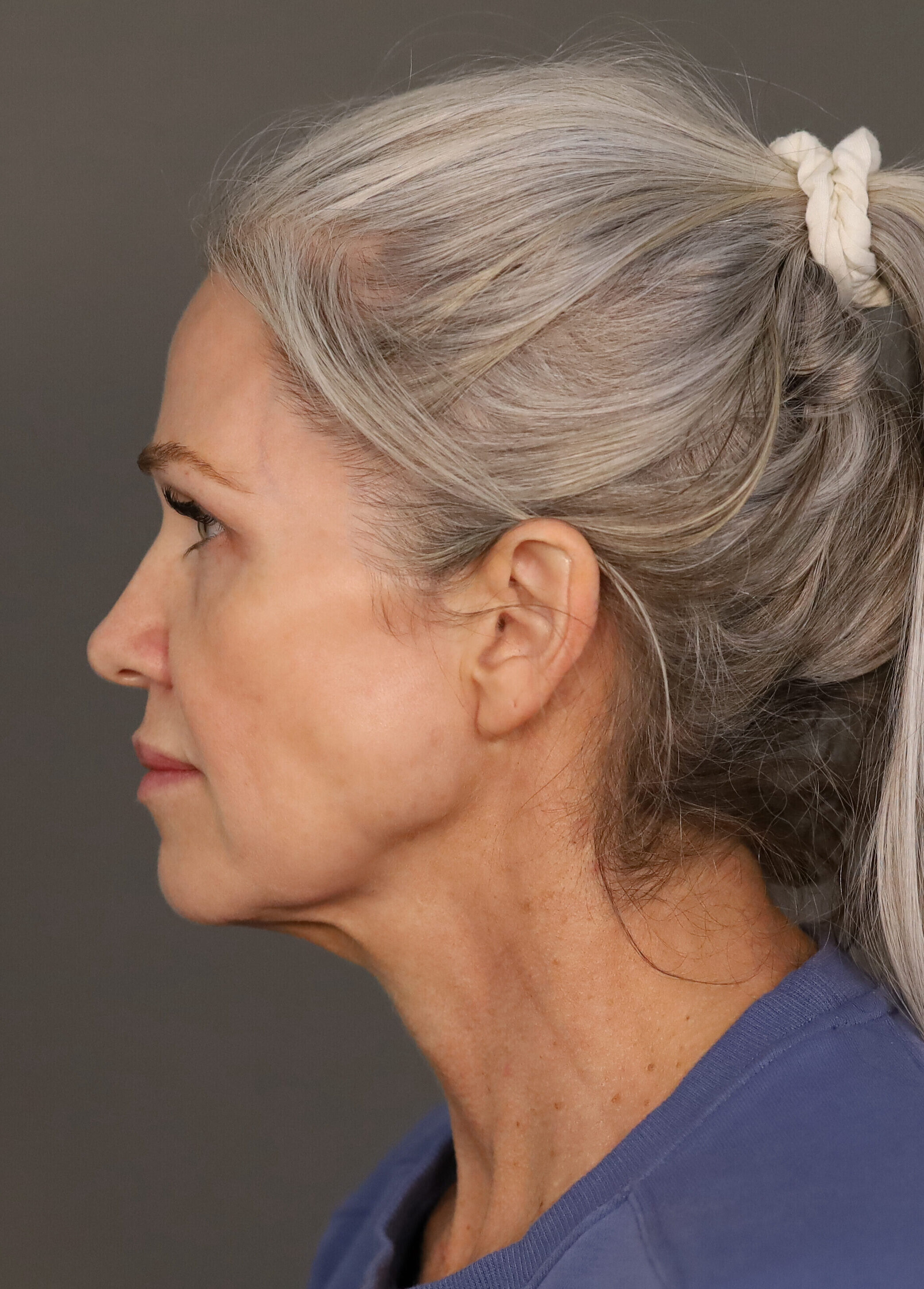 Shannon M Lateral Pre