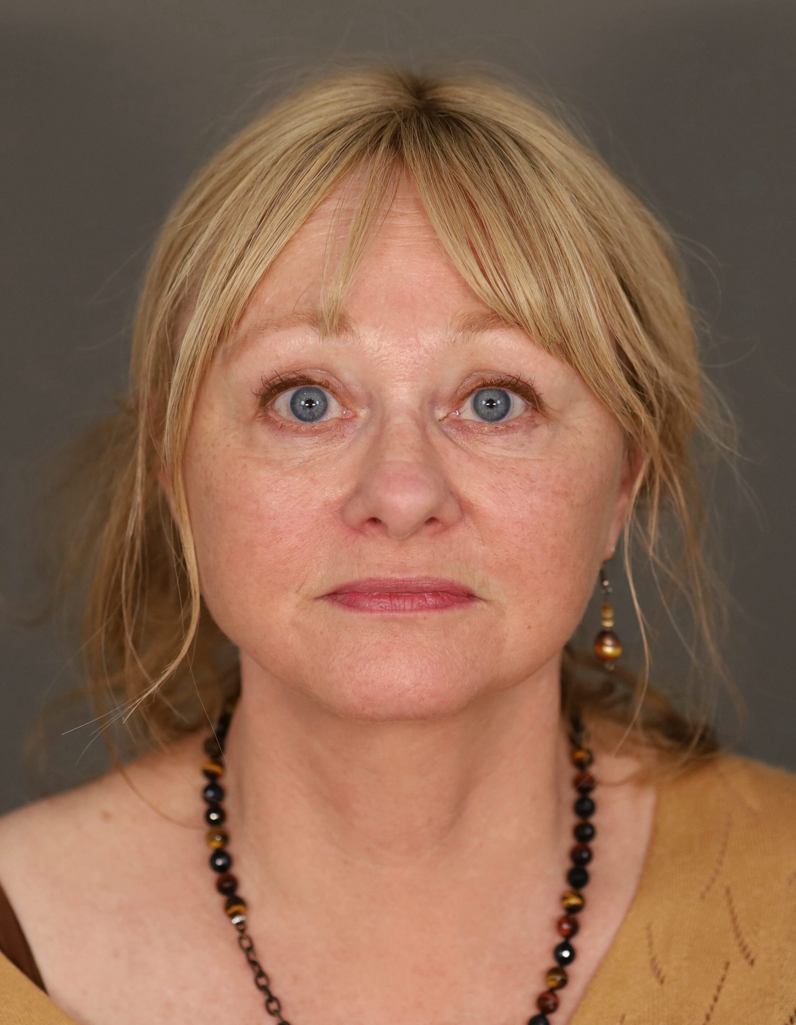 Barbara Frontal Post