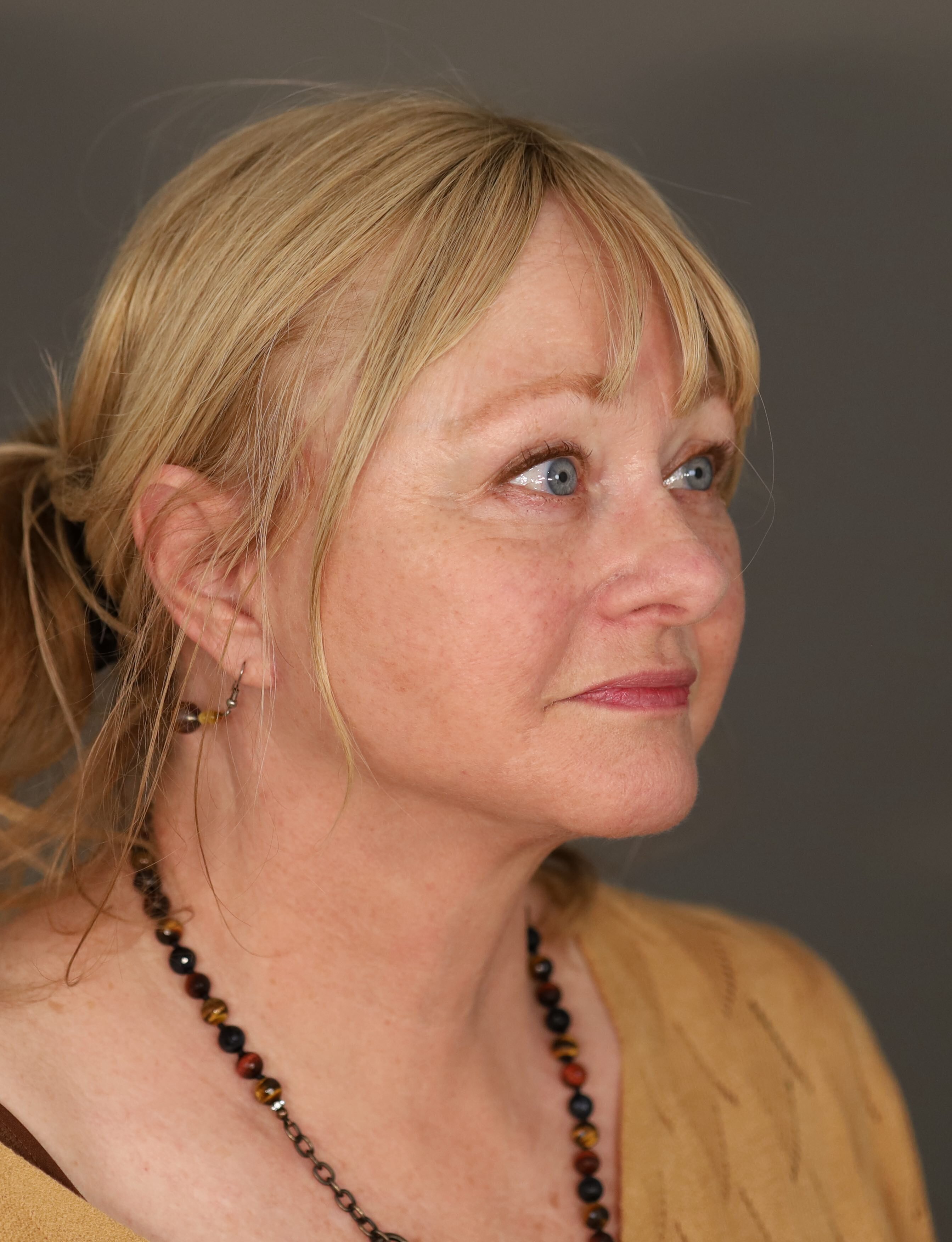 Barbara Lateral Post